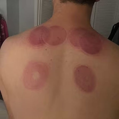 TotalRelief